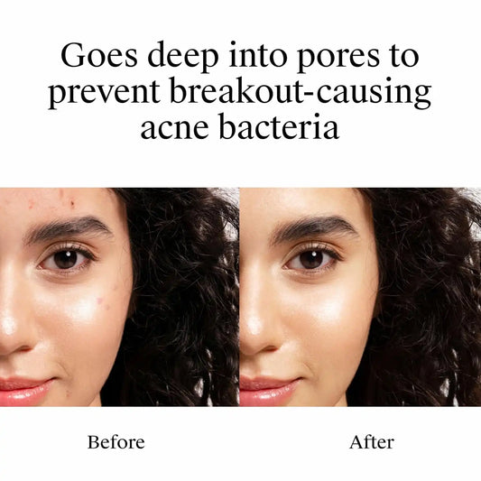 Neutrogena On-The-Spot Acne Spot Treatment Cream, 0.75 oz