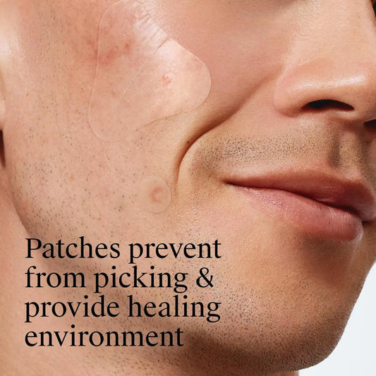 Neutrogena Stubborn Acne Patches, Ultra-Thin Pimple Patches, 24 Ct