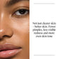 Neutrogena Oil Free Acne Face Wash with Salicylic Acid 16, fl. oz