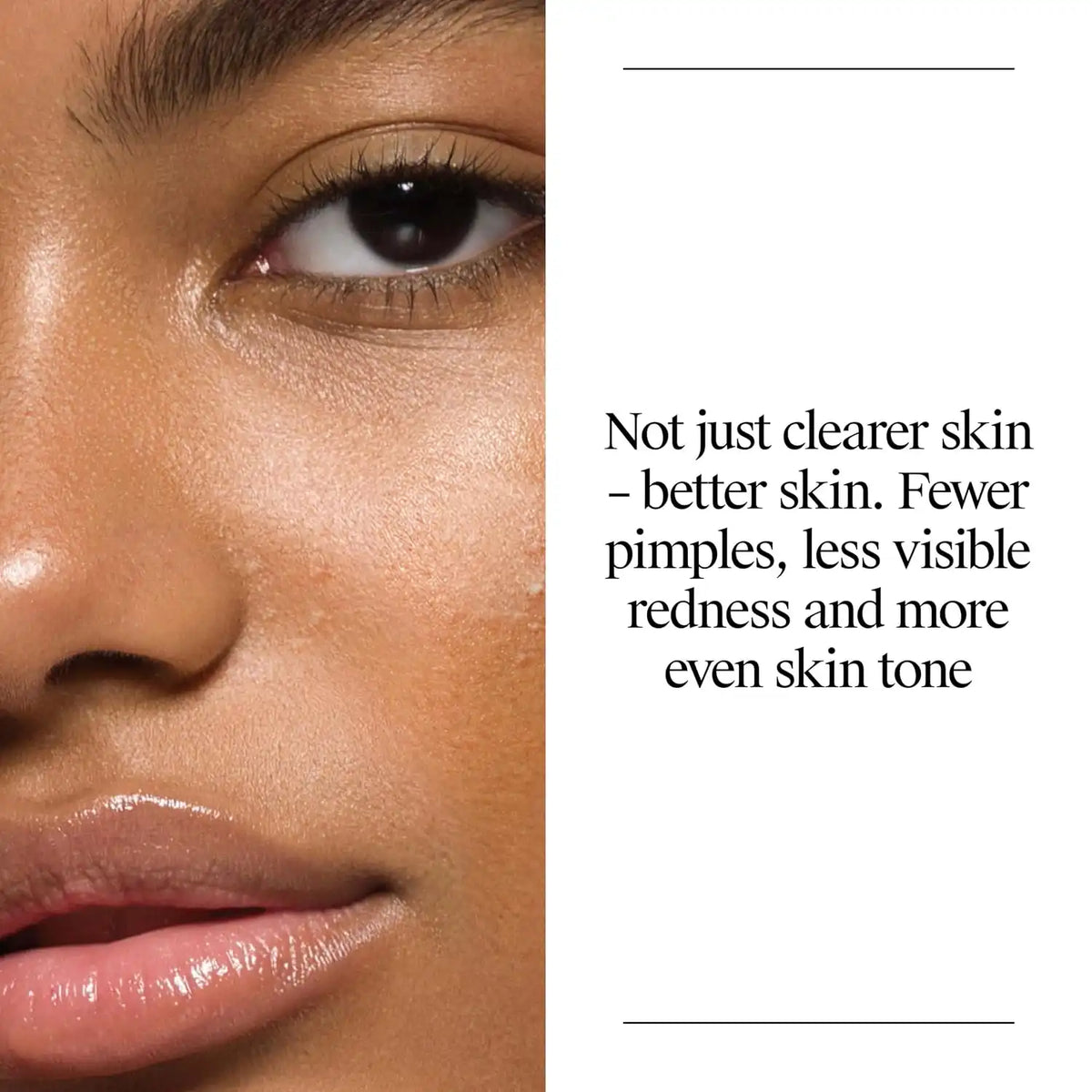 Neutrogena Oil Free Acne Face Wash with Salicylic Acid 16, fl. oz