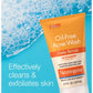 Neutrogena Oil Free Daily Acne Face Scrub, 2 x 4.2 oz